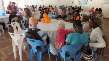 Albinos beneficiam de consultas oftalmológicas gratuitas em Moçambique